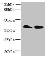 Polyclonal Rabbit anti-Human L3HYPDH / C14orf149 Antibody (IHC, WB)