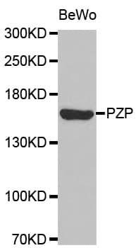 Polyclonal Rabbit anti-Human PZP Antibody (WB)