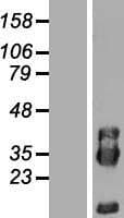 PIK3IP1 / HGFL Protein (Over-Expression Lysate Myc-DDK (Flag))