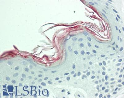 IHC-plus™ Polyclonal Rabbit anti-Human KLK5 / Kallikrein 5 Antibody (IHC, WB)