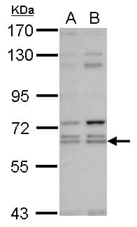 Polyclonal Rabbit anti-Human KLHL12 Antibody (WB)