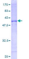 Human AKTIP / FTS Protein (Recombinant GST)