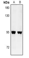 Polyclonal Rabbit anti-Human GFM2 Antibody (IHC, IF, WB)
