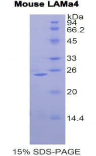 Mouse LAMA4 / Laminin Alpha 4 Protein (Recombinant His)