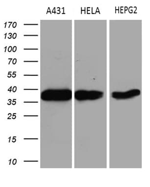 Monoclonal Mouse anti-Human TALDO1 / Transaldolase 1 Antibody (clone OTI1A5, IHC, WB)