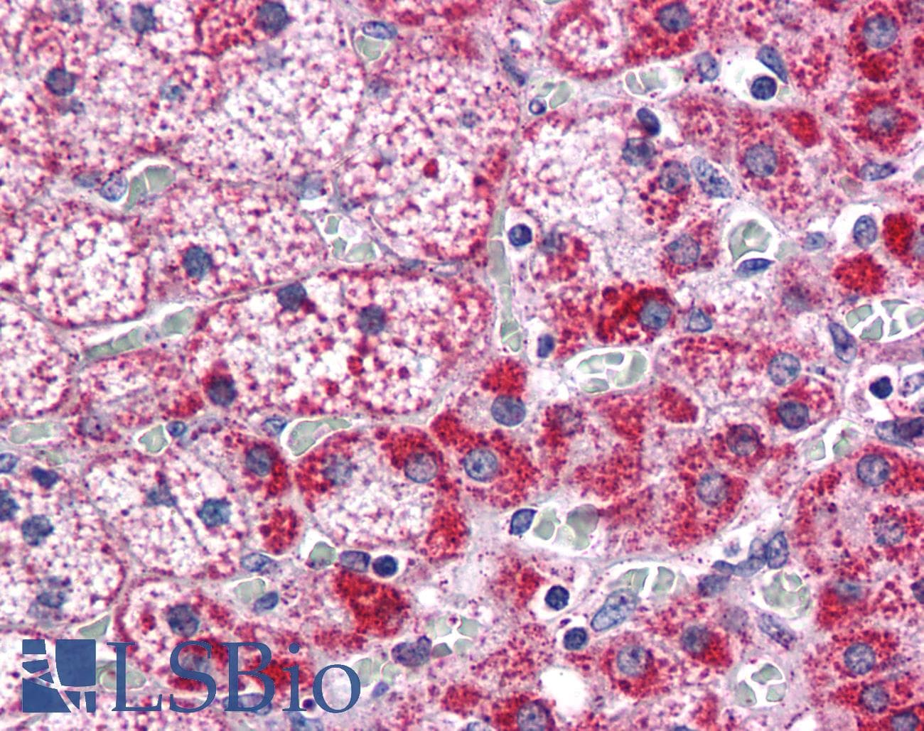 IHC-plus™ CYP26B1 Antibody