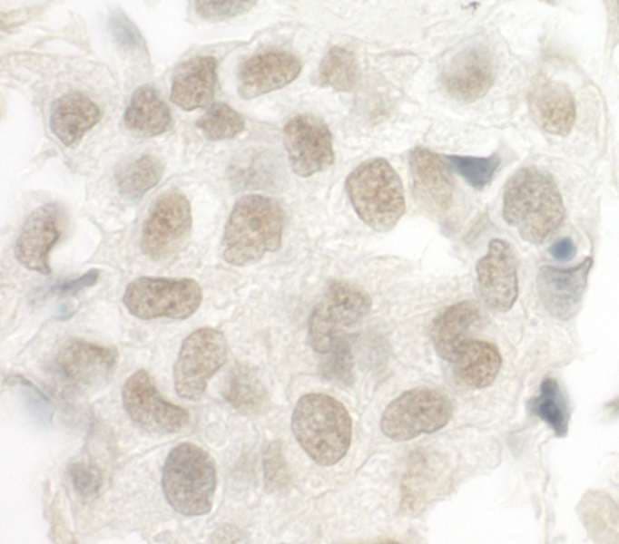 Polyclonal Rabbit anti-Human FOXP1 Antibody (aa627-677, IHC)