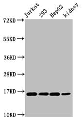 Polyclonal Rabbit anti-Human HIST1H3A Antibody (IHC, IF, WB)