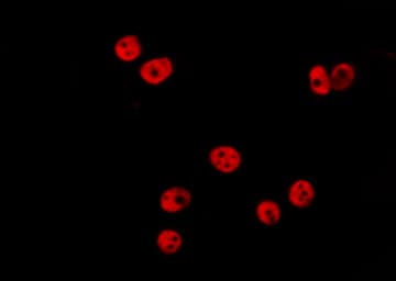 Polyclonal Rabbit anti-Human HIST3H3 Antibody (Methyl-Lys36, IF, WB)