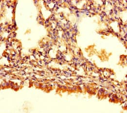 Polyclonal Rabbit anti-Human ASB10 Antibody