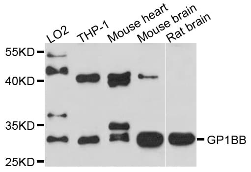 GP1BB / CD42c Antibody