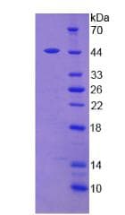 Human Leptin Protein (Recombinant His)