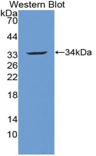 ACTN3 Antibody (aa162-416)
