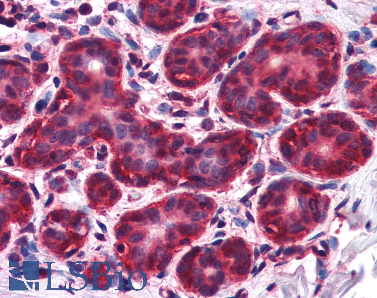 IHC-plus™ Polyclonal Goat anti-Human ALS2CR1 / NIF3L1 Antibody (aa365-377, IHC, WB)