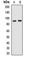 Polyclonal Rabbit anti-Human AMPD1 Antibody (IHC, WB)