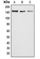 ARID4B Antibody (Internal)
