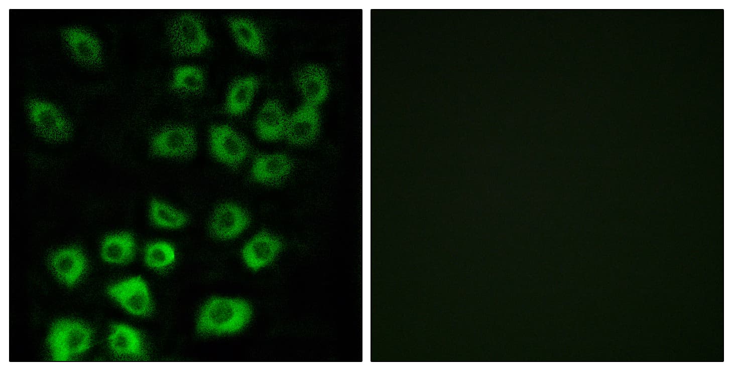 Polyclonal Rabbit anti-Human ARFGAP1 Antibody (aa171-220, IF, WB)