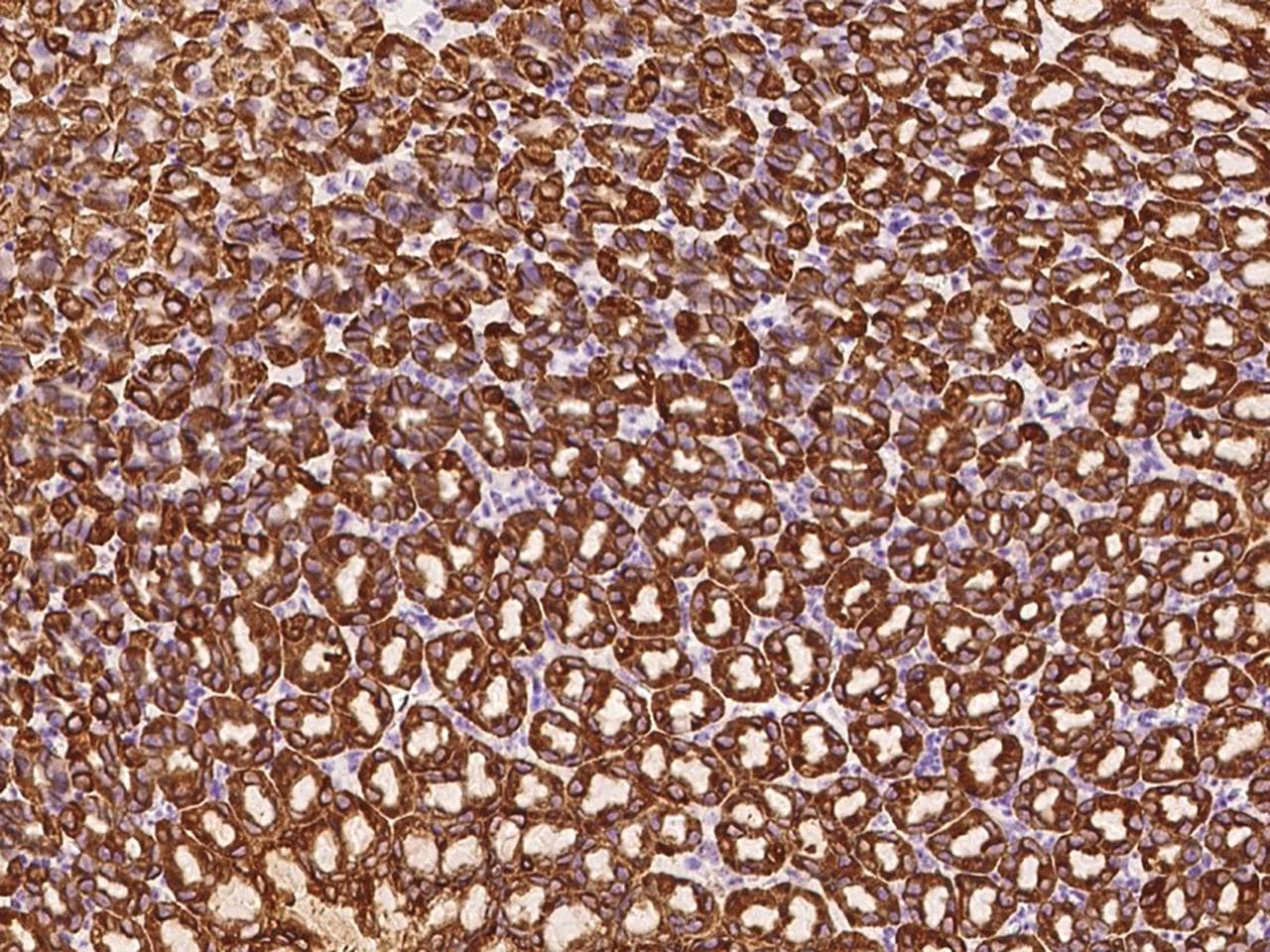 CTSE / Cathepsin E Antibody