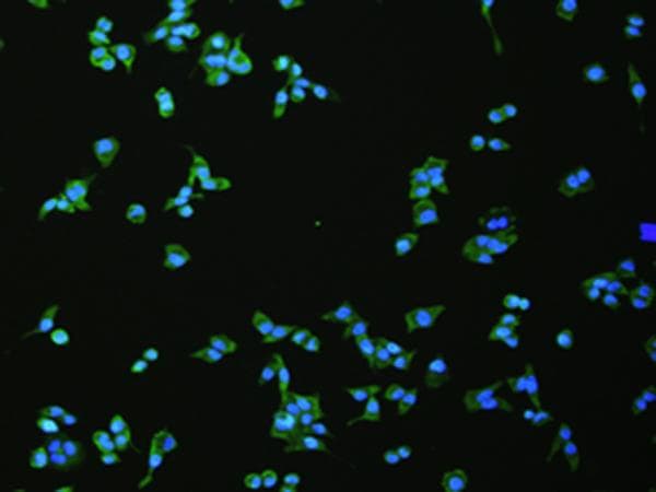 FLT4 / VEGFR3 Antibody
