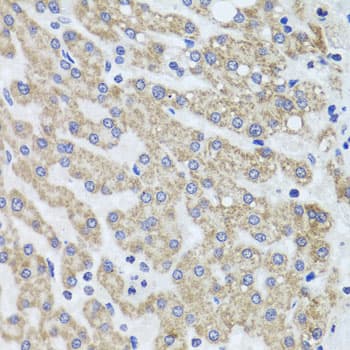 ACP1 / Acid Phosphatase Antibody