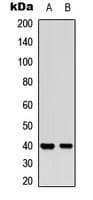 MCL1 / MCL 1 Antibody (phospho-Ser159)
