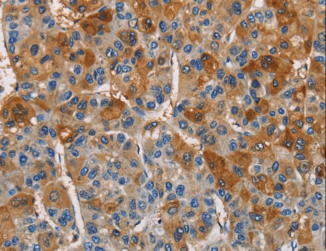 Polyclonal Rabbit anti-Human CST4 / Cystatin S Antibody (IHC)