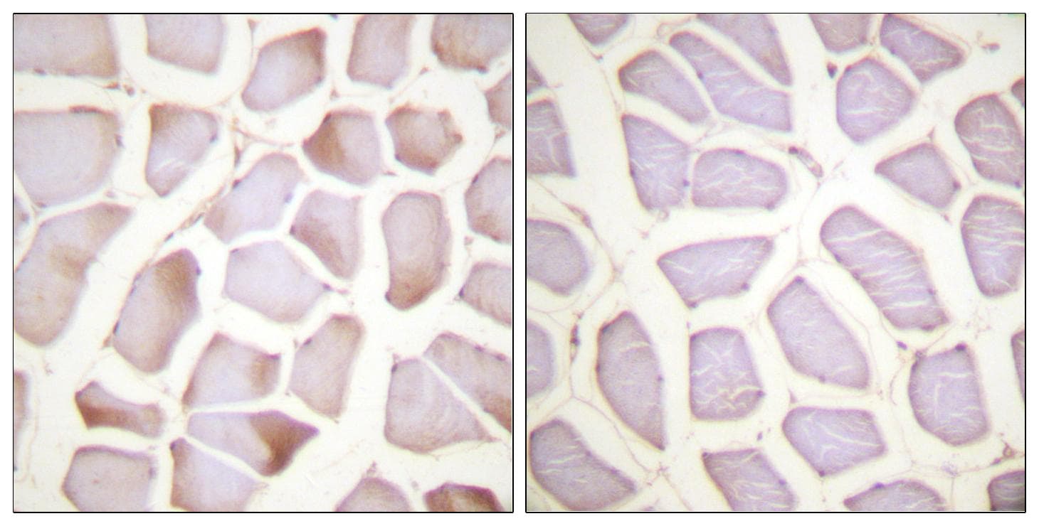 TNNI3 / Cardiac Troponin I Antibody (phospho-Ser22+Ser23)