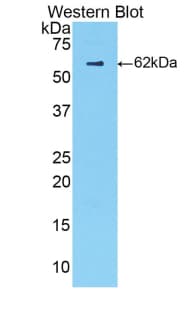 CFB / Complement Factor B Antibody (aa34-159, APC, Cy7)