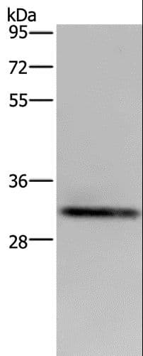 ICAM4 / CD242 Antibody