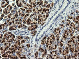 Monoclonal Mouse anti-Human PIK3CG / PI3K Gamma Antibody (clone OTI6C6, IHC, WB)