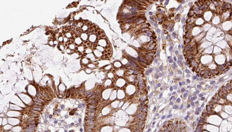 Polyclonal Rabbit anti-Human IFT20 Antibody (IHC, WB)