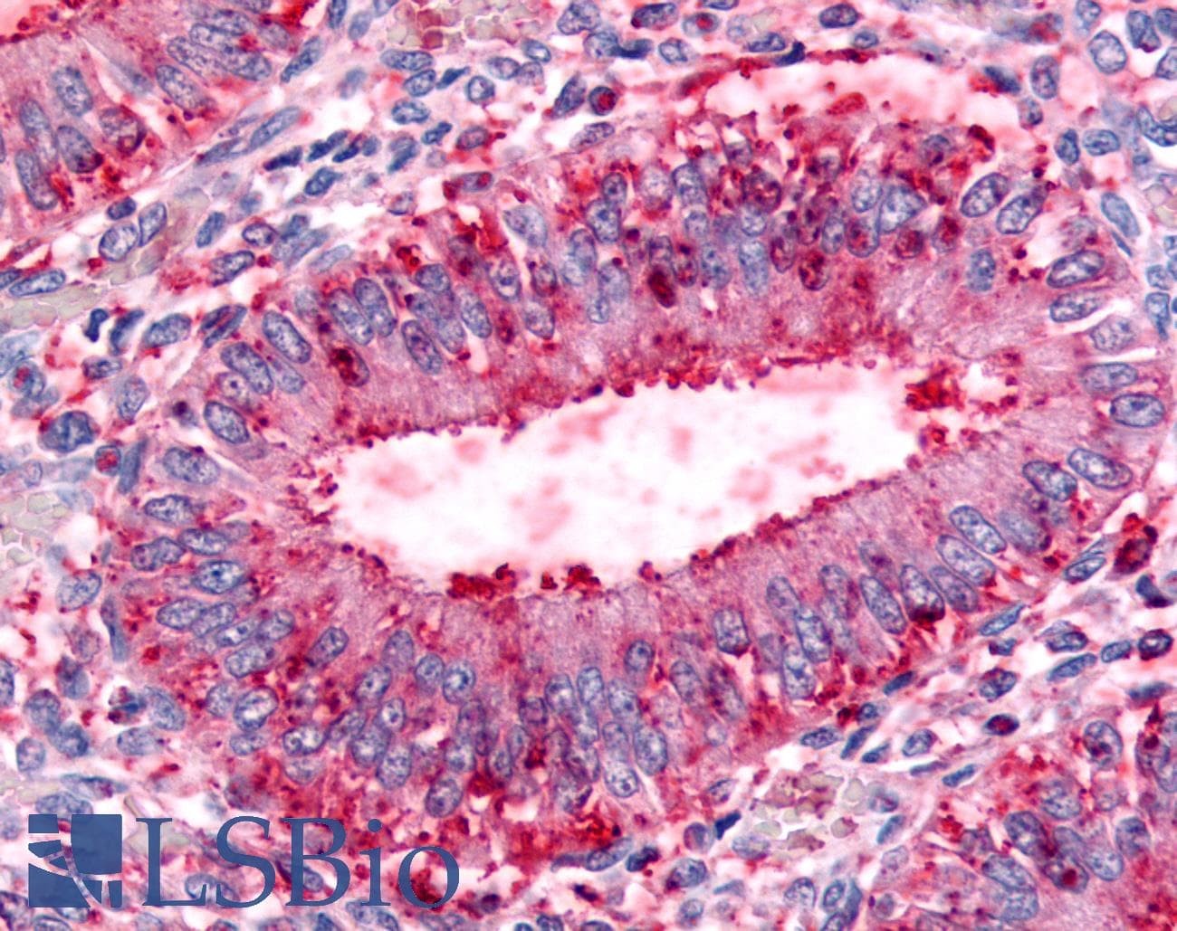 IHC-plus™ Dipeptidylpeptidase 8 / DPP8 Antibody (Internal)