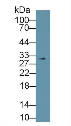 Prohibitin Antibody (aa177-272, Cy3)