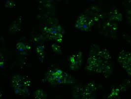 Monoclonal Mouse anti-Human PSMC3 Antibody (clone OTI7B10, IHC, IF, WB)