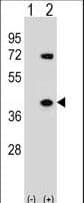 HNRPA1 / HnRNP A1 Antibody (aa266-294)