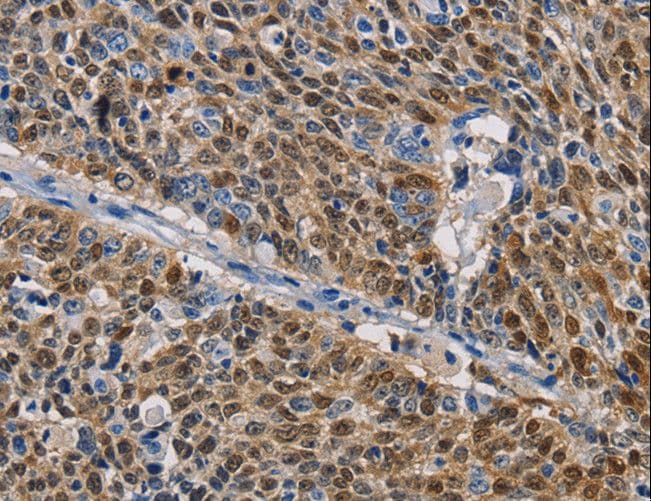 GSTA2 Antibody