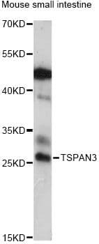 Polyclonal Rabbit anti-Human TSPAN3 Antibody (WB)