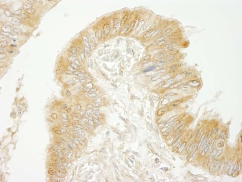 ARFGEF2 / BIG2 Antibody (aa300-350)