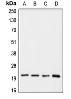 Polyclonal Rabbit anti-Human CLDN1 / Claudin 1 Antibody (C-Terminus, IHC, WB)