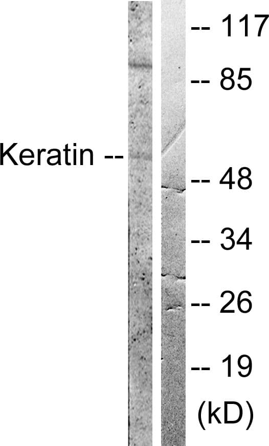 IHC-plus™ KRT8 / CK8 / Cytokeratin 8 Antibody (aa41-90)
