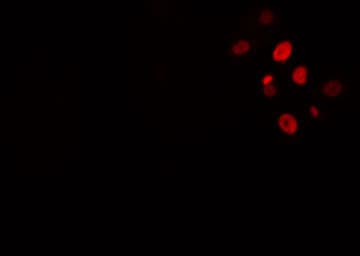 Polyclonal Rabbit anti-Human HIPK4 Antibody (IHC, IF, WB)