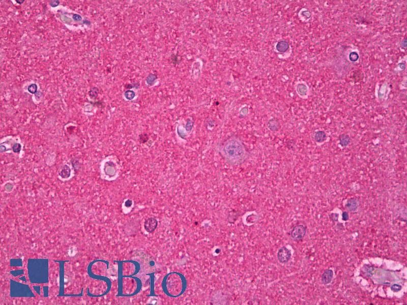 IHC-plus™ Polyclonal Rabbit anti-Human MAPT / Tau Antibody (IHC, WB)