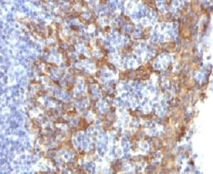 KRT14 / CK14 / Cytokeratin 14 Antibody (clone CTKN14-1, Ready-to-Use)