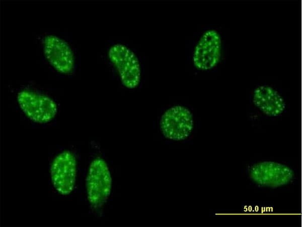 IHC-plus™ Monoclonal Mouse anti-Human TSC22D3 / GILZ Antibody (clone 3A5, IHC, IF, WB)