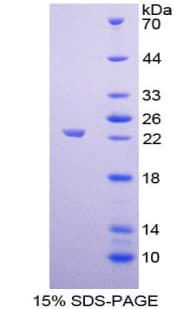 Rat LGALS8 / Galectin 8 Protein (Recombinant His-T7)