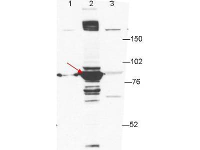 ESRP1 / RBM35A Antibody (clone 27H12.F3.H5)