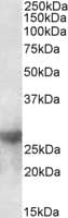 IHC-plus™ LGALS3 / Galectin 3 Antibody (aa155-168)