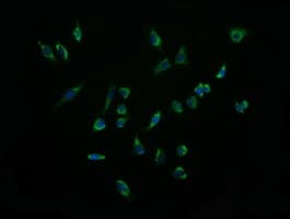 Monoclonal Mouse anti-Human ACAA2 Antibody (clone OTI2F6, IHC, IF, WB)