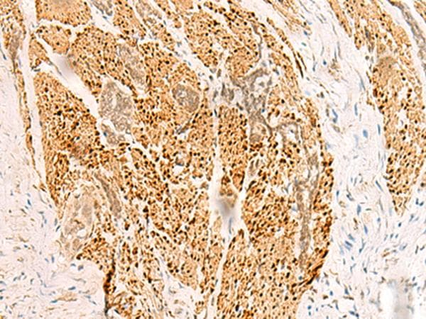 Polyclonal Rabbit anti-Human RFX6 Antibody (IHC)