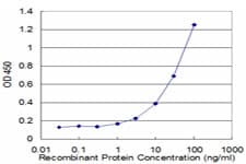 Monoclonal Mouse anti-Human ACAT2 Antibody (clone 4A5, WB)